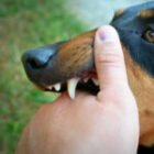 What to Do After a Dog Bite in Georgia